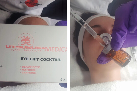 microneedling eye lift process 5