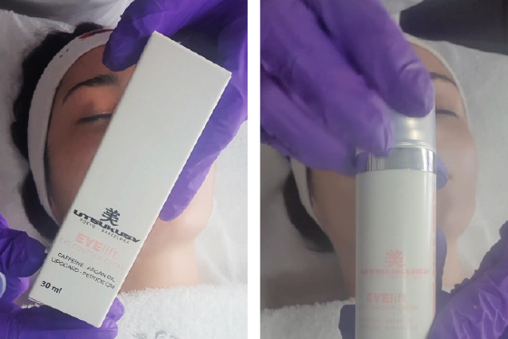 microneedling eye lift process 8