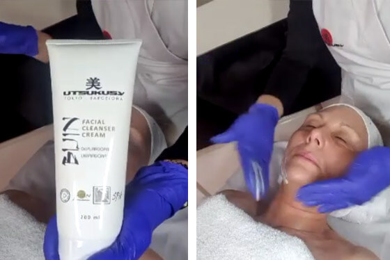 microneedling neck lift process 2